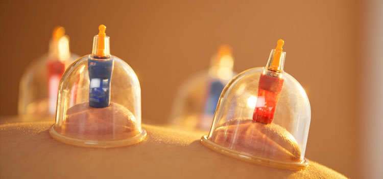 Cupping